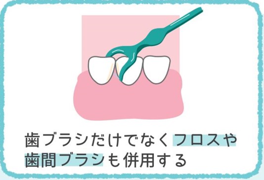 歯ブラシだけでなくフロスや歯間ブラシも併用する