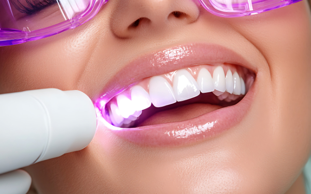 オフィスホワイトニングの施術を受ける女性